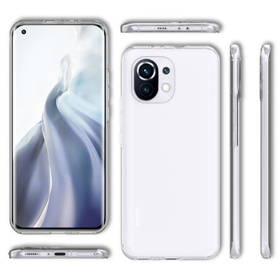 NALIA 360° Hülle für Xiaomi Mi 11 – Vorne & Hinten Schutz – 360GUARD (Full-Body Case) – Marke aus Berlin Default Title NALIA Transparente Hülle